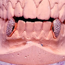 Cap Prata + Banho Ouro Rosé + Zircônia